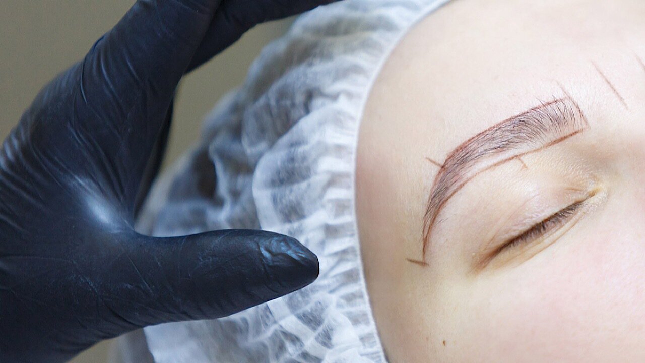 نقاهت بعد از کاشت ابرو