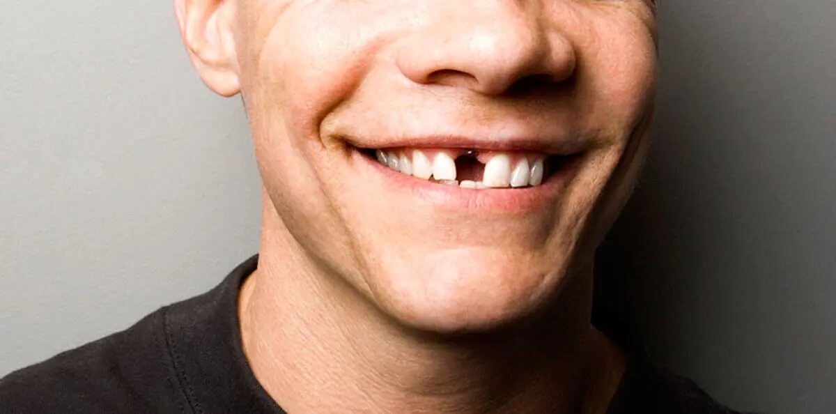 «شرم از لبخند» درد جدید ایرانیان فقیر شده