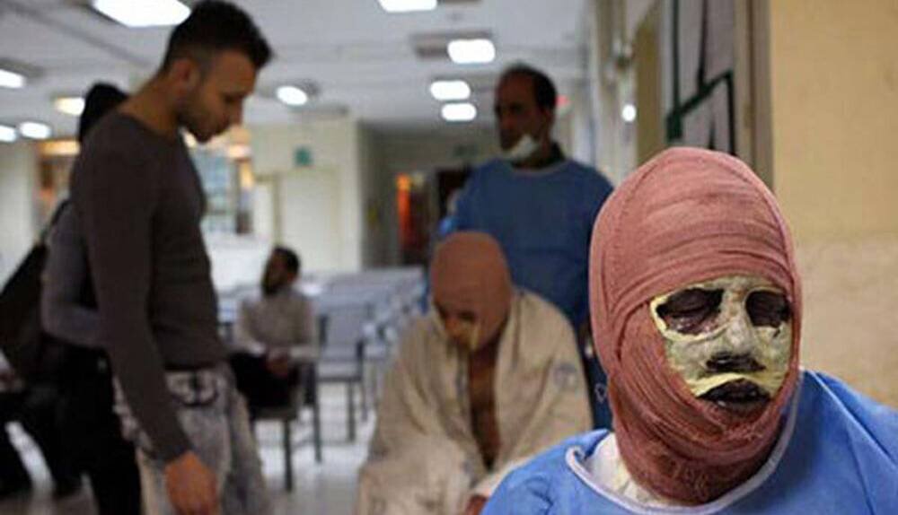 ایرانیها ۸ برابر میانگین جهانی میسوزند!