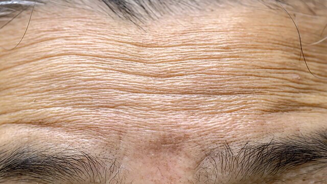 ترکیب فناوری نانو و زیستفناوری برای جوانسازی طبیعی و ماندگار پوست