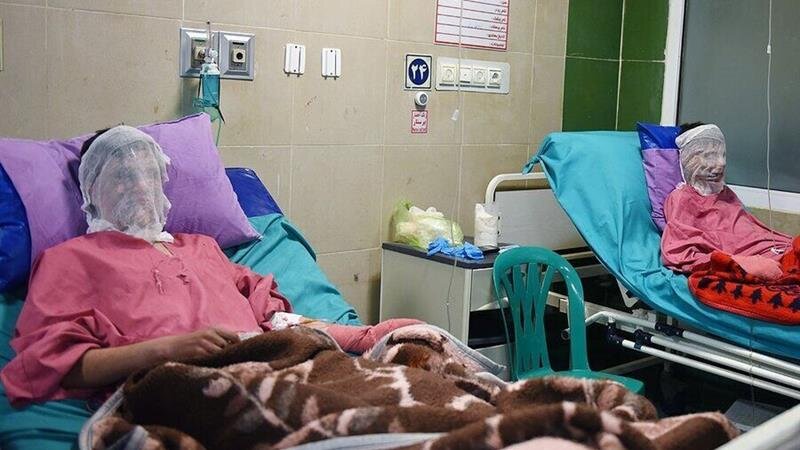 ثبت رکورد امیدبخش در فارس؛ درمان ۴۰ درصد از مصدومان با بیش از ۵۰ درصد سوختگی در شیراز