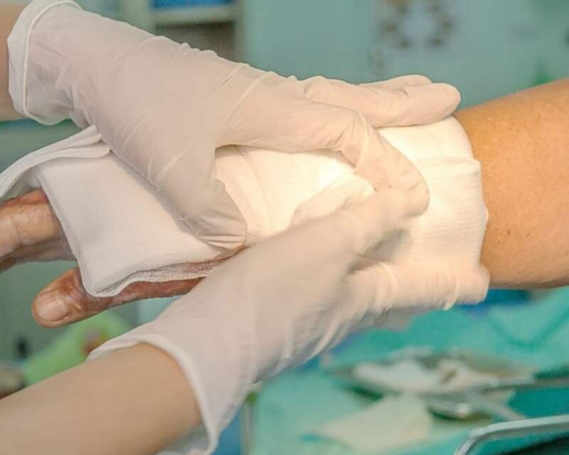 پانسمان‌های نوین⁩ برای اولین بار تحت پوشش بیمه قرار گرفت