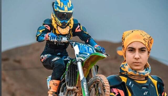 آخرین وضعیت دختر موتورسوار پس از ۳۴ روز کما