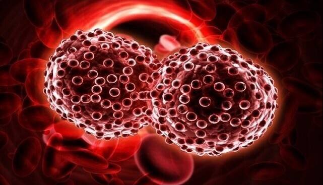 سرطان‌های حاد خون با علائم شدید و سریع بروز می‌کنند