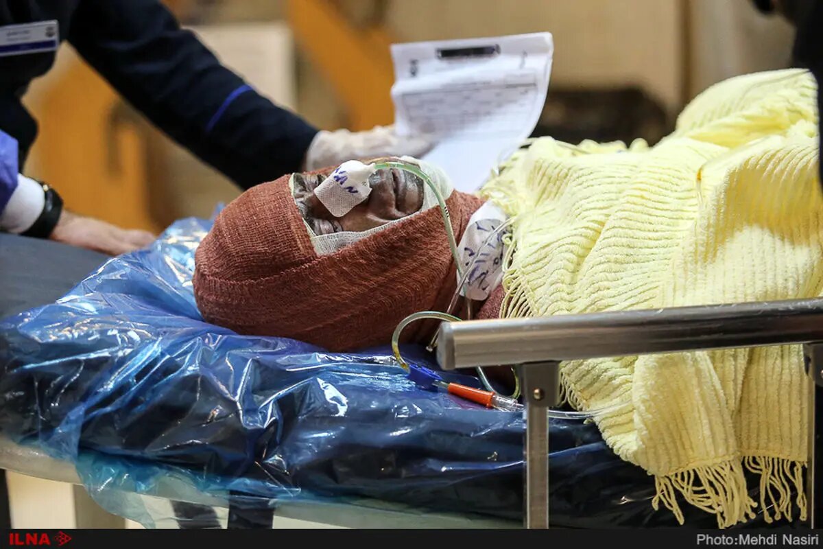 ۱۲۰۰ تخت سوختگی در کشور کم داریم