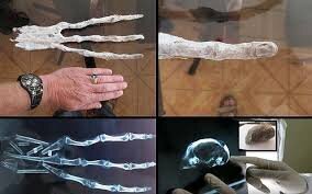 اسرار پنجانگشت انسان/ چرا دستوپای ما دقیقاً پنجانگشت دارد؟