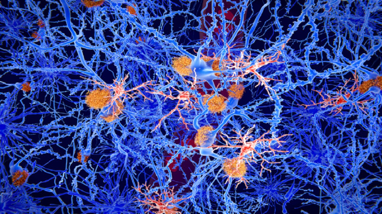 درمانی نوآورانه برای صرع که حافظه را بازیابی و از تشنج جلوگیری می‌کند