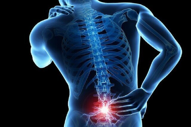دلیل شیوع کمردرد در میان دانشآموزان چیست؟
