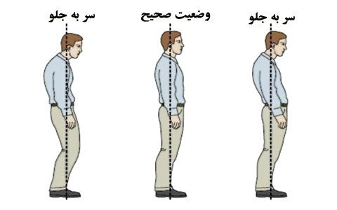 تمرینات اصلاحی برای رفع ناهنجاری «سر به جلو»