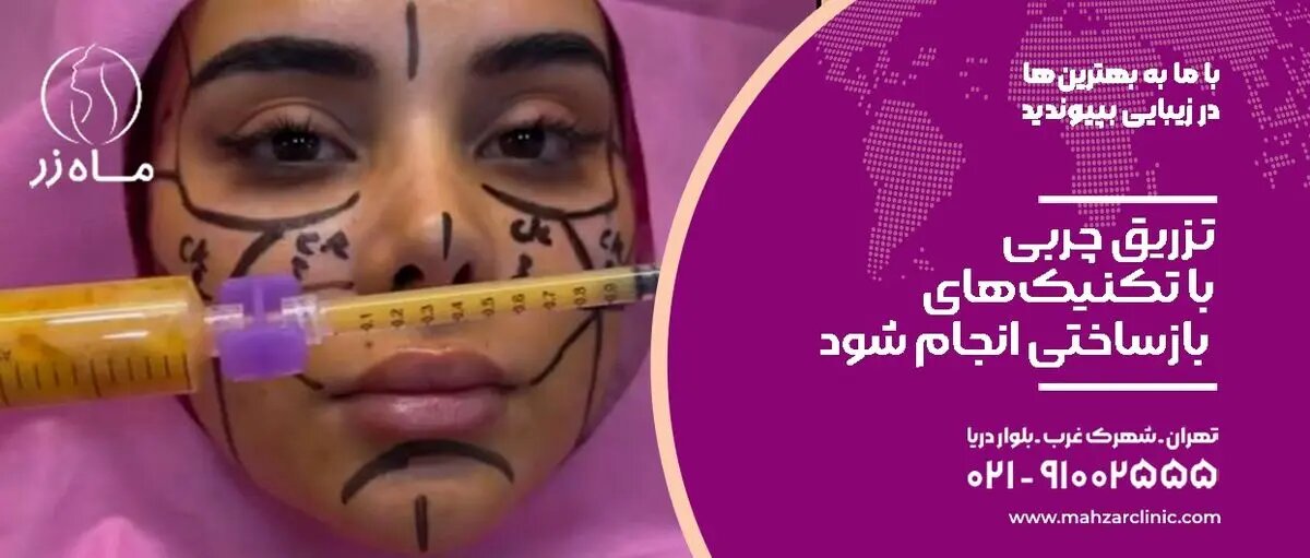 تزریق چربی را انجام ندهید!