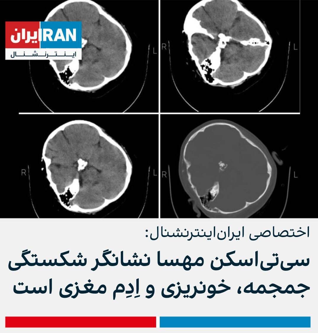 چرا آمارهای اینترنشنال قابل اعتماد نیست؟