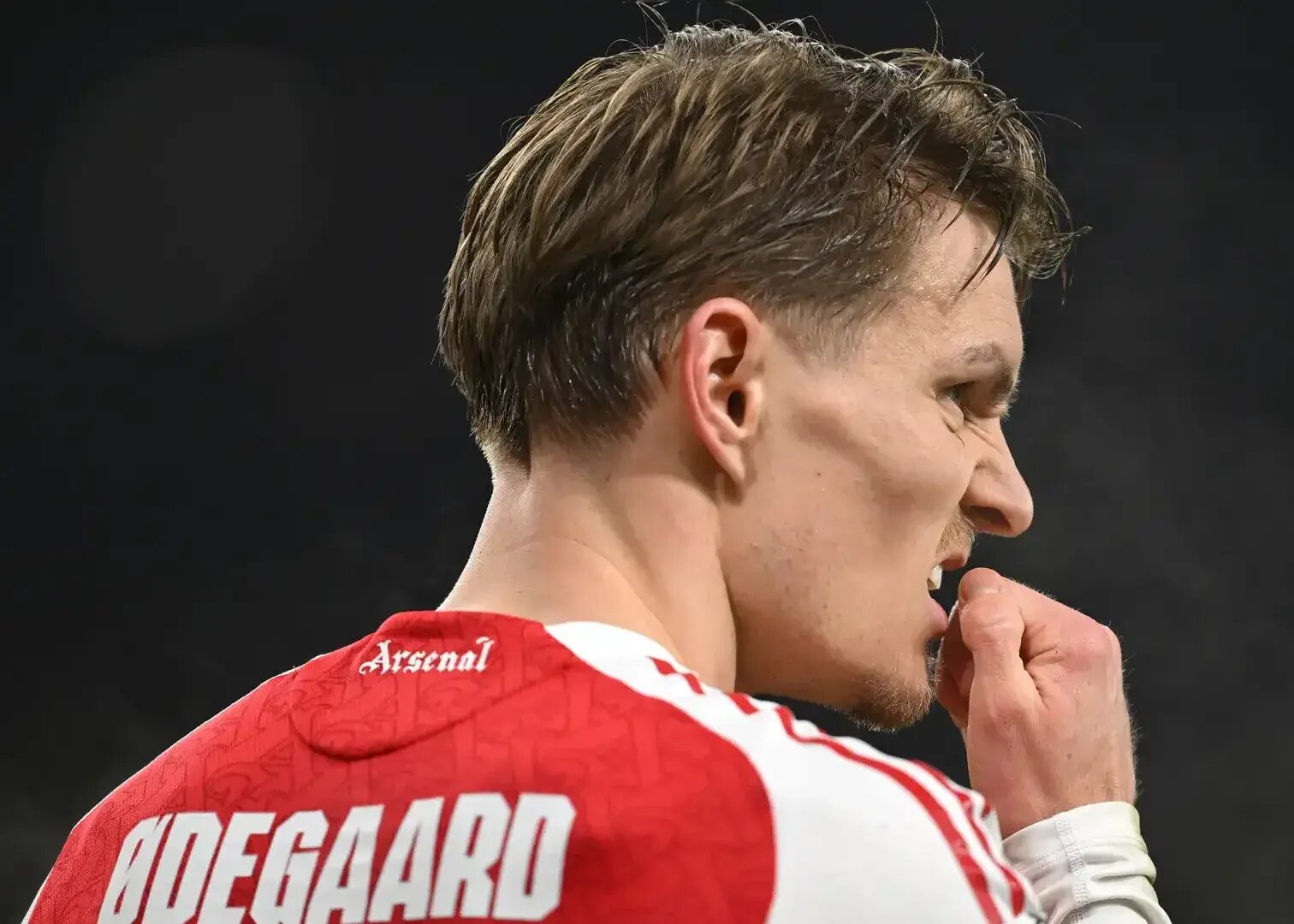 ادامه کابوس آرسنال؛ کاپیتان مصدوم شد