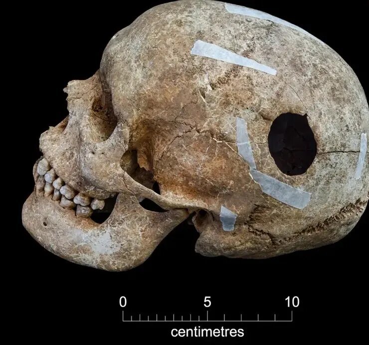 گودال ترسناک پر از اسکلت در یک مزرعه | عکس