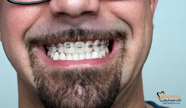 بهترین متخصص ارتودنسی برای بزرگسالان