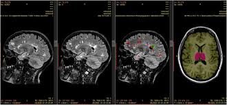 پاسخ نتیجه MRI فقط در چند ثانیه!