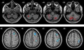 پاسخ نتیجه MRI فقط در چند ثانیه!