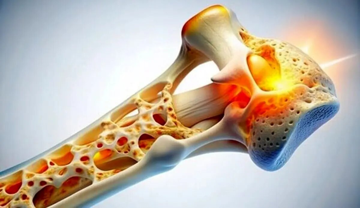کدام خوراکیها برای سلامت استخوانها خطرناکند؟