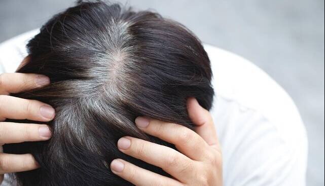 نشانه احتمالی ابتلا به پارکینسون در موها پنهان است