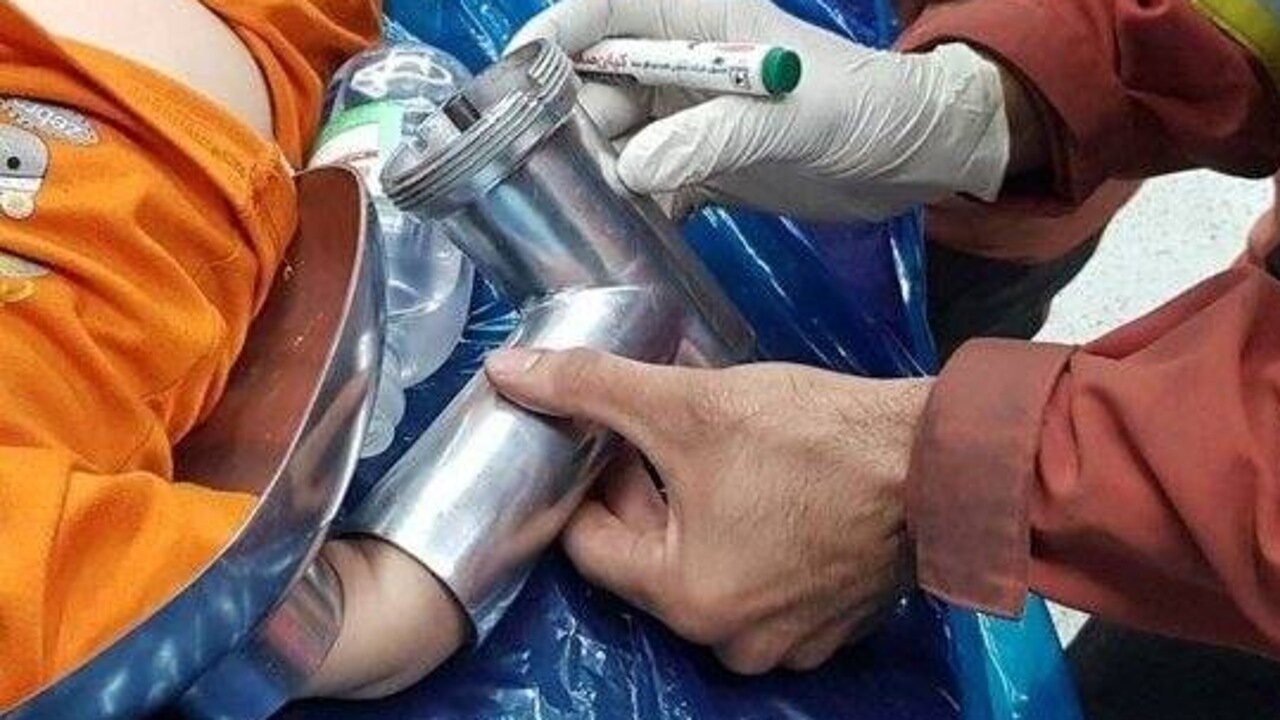 دست کودک دو ساله در چرخگوشت گیر کرد؛ اقدام گروه نجات ویژه آتشنشانی برای رهاسازی