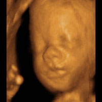 تصویری: سونوگرافی چهار بعدی در بارداری