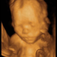 تصویری: سونوگرافی چهار بعدی در بارداری
