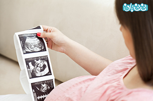 سونوگرافی های ضروری در بارداری