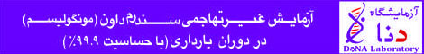 احتمال سقط به دلیل ضعیف بودن نطفه هست؟