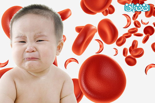 خطر درمان نکردن کم خونی قبل از بارداری