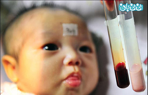 نوزادی با خون صورتی + تصویر