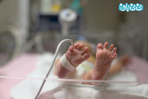 خطر مشکلات قلبی و مغزی در نوزادان نارس