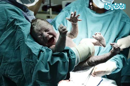 اولین تزریق در اولین دقیقه تولد