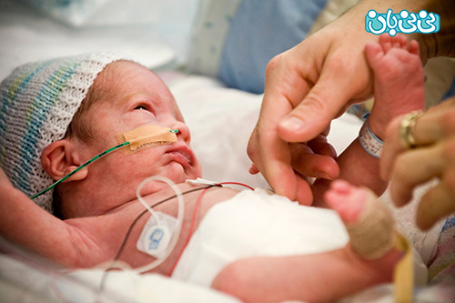 5 احتیاط مهم برای نوزادان نارس