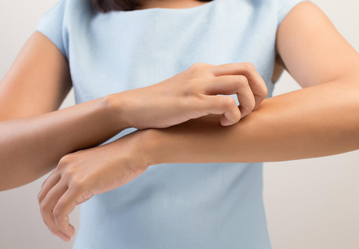عوامل ایجاد حساسیت پوستی؛ نشانه‌ها و راه‌‌های درمان آن | چطور