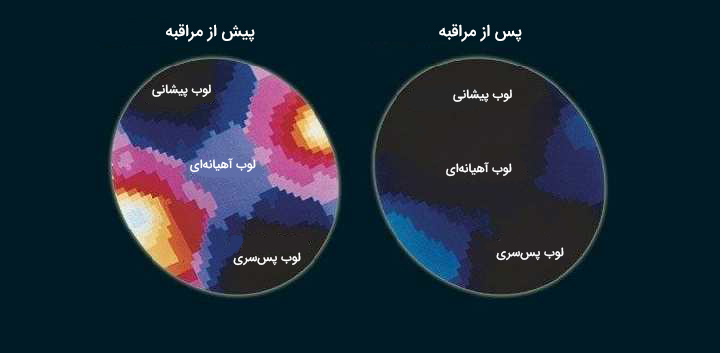 مراقبه چیست و چه تاثیری بر ذهن ما دارد؟