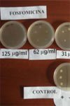 مقایسه تفاوت های فسفومایسین و فوزباک در محیط آزمایشگاهی
