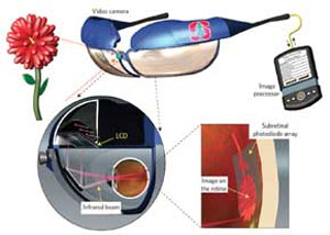 چشم روشنی فناوری برای نابینایان
