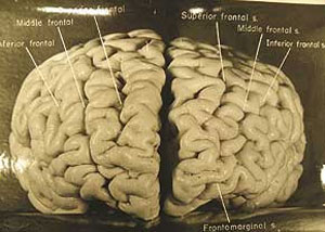 نتایج کالبد شکافی مغز اینشتین
