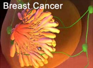 چه غذاهایی به پیشگیری از سرطان سینه کمک می کنند