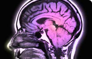 با پیشرفت آلزایمر و دیگر بیماریهایی که منجر به تخریب عملکرد مغز می شوند
