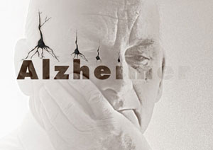 آلزایمر تصورات نادرست و حقایق