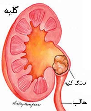 سلطان دردها