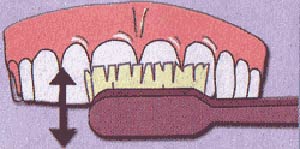 بهداشت دهان و دندان و صرع