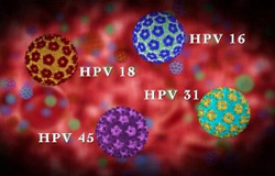 ویروس HPV را چقدر می شناسید