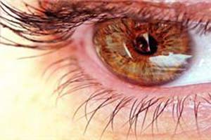 عفونت چشمی