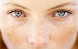 لک های پوستی چرا و چطور ظاهر می شوند