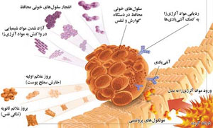 آلرژی تهدید زندگی مدرن