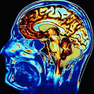 ضربه های مغزی علت ها و درمان