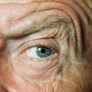 بیماری های چشم سالمندان