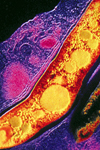 حساسیت سویه های مایکوباکتریوم توبرکلوزیس و مایکوباکتریوم های غیر توبرکلوزی نسبت به کانامایسین و امیکاسین