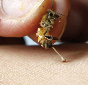 با نیش زنبور از شر این بیماری ها خلاص شوید